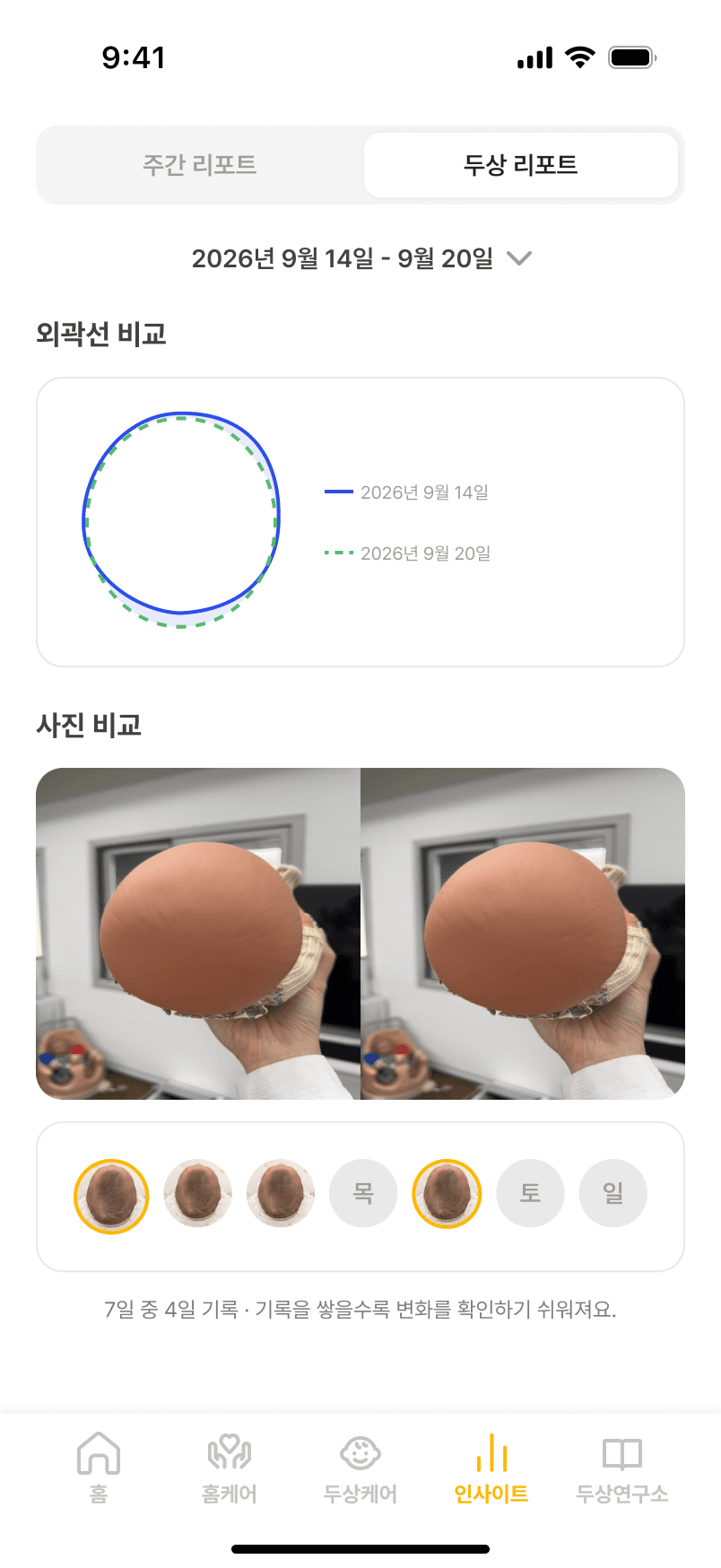 바로도리 두상 리포트, 외곽선 비교와 사진 비교